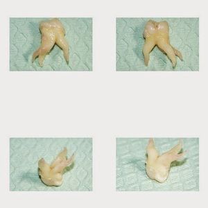 Meet your Posher, Alister